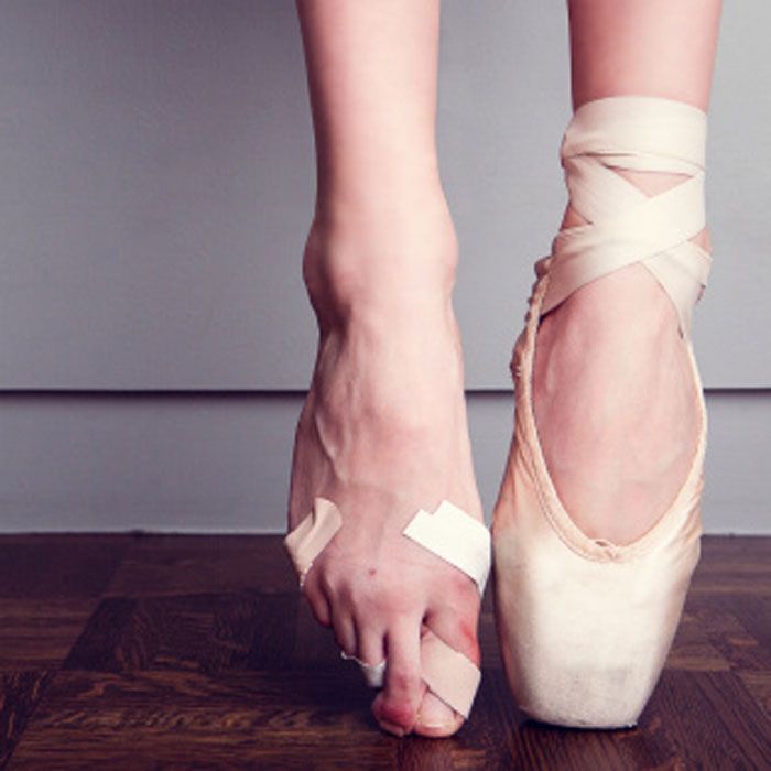 dance injuries