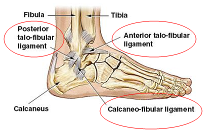 ankle-sprain-eastern-foot-care-podiatry