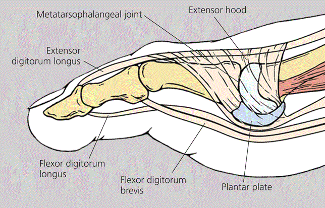 footlab-why-do-i-get-pain-under-the-front-of-my-foot-plantar